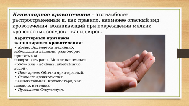 Капиллярное кровотечение – это наиболее распространенный и, как правило, наименее опасный вид кровотечения, возникающий при повреждении мелких кровеносных сосудов – капилляров. Характерные признаки капиллярного кровотечения: • Кровь: Выделяется медленно, небольшими каплями, равномерно пропитывая поверхность раны. Может напоминать «росу» или «мочалку, намоченную водой». • Цвет крови: Обычно ярко-красный. • Скорость кровотечения: Незначительная. Кровопотеря, как правило, невелика. •  Пульсация : Отсутствует. 