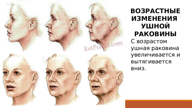ВОЗРАСТНЫЕ ИЗМЕНЕНИЯ УШНОЙ РАКОВИНЫ С возрастом ушная раковина увеличивается и вытягивается вниз. 