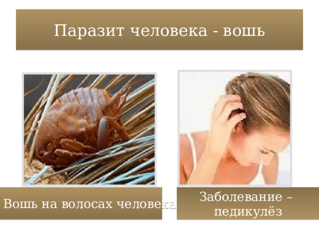 Паразит человека - вошь Заболевание – педикулёз Вошь на волосах человека 