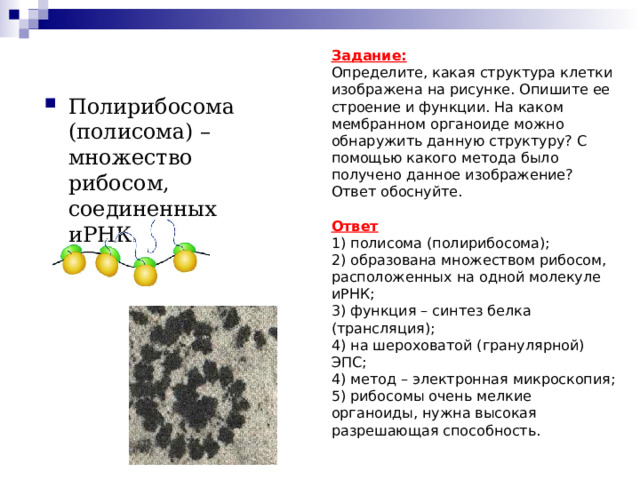 Задание: Определите, какая структура клетки изображена на рисунке. Опишите ее строение и функции. На каком мембранном органоиде можно обнаружить данную структуру? С помощью какого метода было получено данное изображение? Ответ обоснуйте. Ответ 1) полисома (полирибосома); 2) образована множеством рибосом, расположенных на одной молекуле иРНК; 3) функция – синтез белка (трансляция); 4) на шероховатой (гранулярной) ЭПС; 4) метод – электронная микроскопия; 5) рибосомы очень мелкие органоиды, нужна высокая разрешающая способность. Полирибосома (полисома) – множество рибосом, соединенных иРНК.  