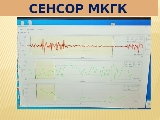 СЕНСОР МКГК 
