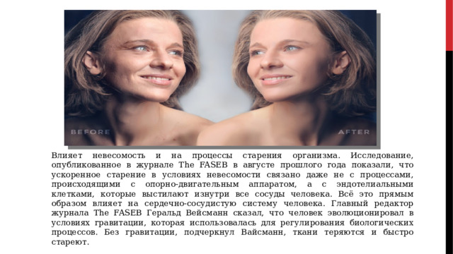 Влияет невесомость и на процессы старения организма. Исследование, опубликованное в журнале The FASEB в августе прошлого года показали, что ускоренное старение в условиях невесомости связано даже не с процессами, происходящими с опорно-двигательным аппаратом, а с эндотелиальными клетками, которые выстилают изнутри все сосуды человека. Всё это прямым образом влияет на сердечно-сосудистую систему человека. Главный редактор журнала The FASEB Геральд Вейсманн сказал, что человек эволюционировал в условиях гравитации, которая использовалась для регулирования биологических процессов. Без гравитации, подчеркнул Вайсманн, ткани теряются и быстро стареют. 