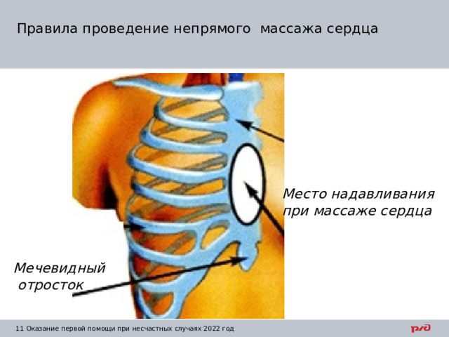 Правила проведение непрямого массажа сердца Место надавливания при массаже сердца Мечевидный  отросток 1  Оказание первой помощи при несчастных случаях 2022 год 