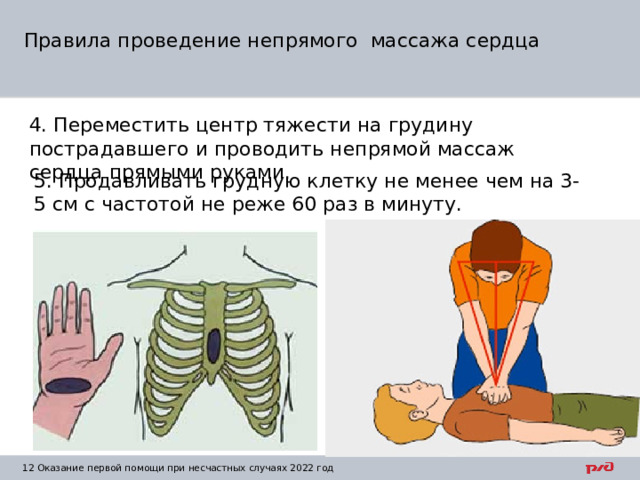 Правила проведение непрямого массажа сердца 4. Переместить центр тяжести на грудину пострадавшего и проводить непрямой массаж сердца прямыми руками. 5. Продавливать грудную клетку не менее чем на 3-5 см с частотой не реже 60 раз в минуту. 1  Оказание первой помощи при несчастных случаях 2022 год 