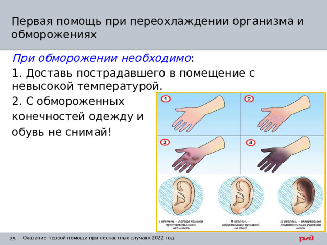 Первая помощь при переохлаждении организма и обморожениях При обморожении необходимо : 1. Доставь пострадавшего в помещение с невысокой температурой. 2. С обмороженных конечностей одежду и обувь не снимай! Оказание первой помощи при несчастных случаях 2022 год 1 