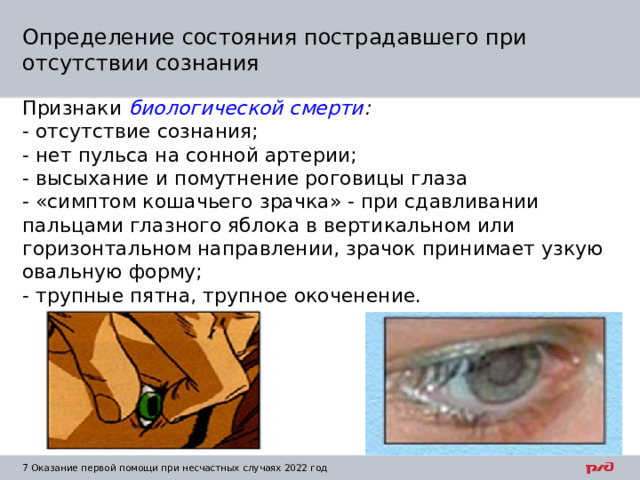 Определение состояния пострадавшего при отсутствии сознания Признаки  биологической смерти : - отсутствие сознания; - нет пульса на сонной артерии; - высыхание и помутнение роговицы глаза - «симптом кошачьего зрачка» - при сдавливании пальцами глазного яблока в вертикальном или горизонтальном направлении, зрачок принимает узкую овальную форму; - трупные пятна, трупное окоченение. 1  Оказание первой помощи при несчастных случаях 2022 год 