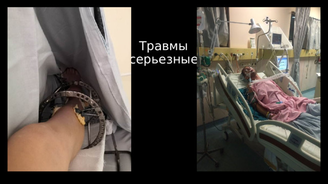 Травмы  (серьезные) 