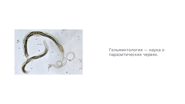 Гельминтология — наука о паразитических червях. 