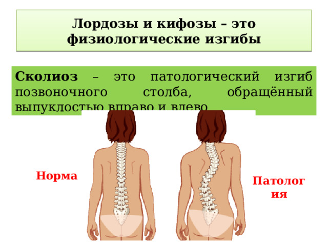 Лордозы и кифозы – это физиологические изгибы Сколиоз – это патологический изгиб позвоночного столба, обращённый выпуклостью вправо и влево Норма  Патология 