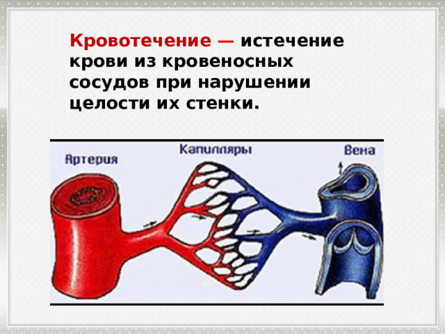 Кровотечение  — истечение крови из кровеносных сосудов при нарушении целости их стенки. 