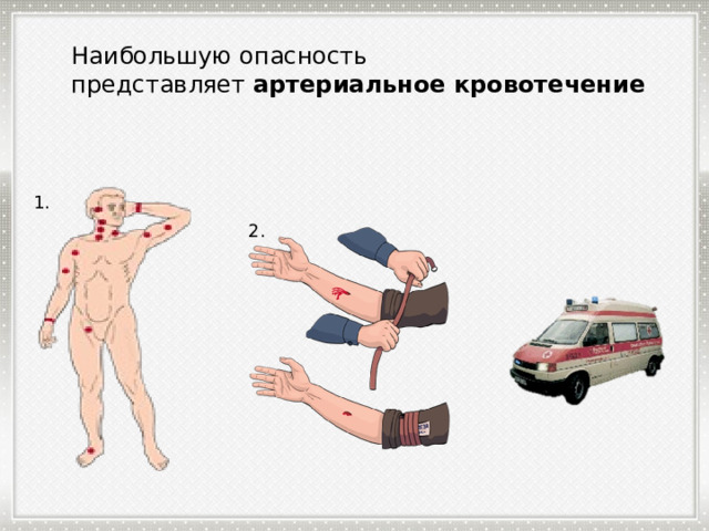 Наибольшую опасность представляет  артериальное кровотечение 1. 2. 