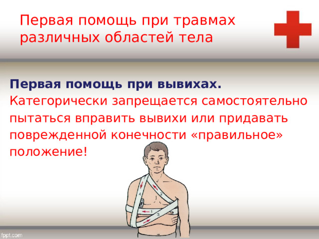 Первая помощь при травмах различных областей тела Первая помощь при вывихах. Категорически запрещается самостоятельно пытаться вправить вывихи или придавать поврежденной конечности «правильное» положение! 