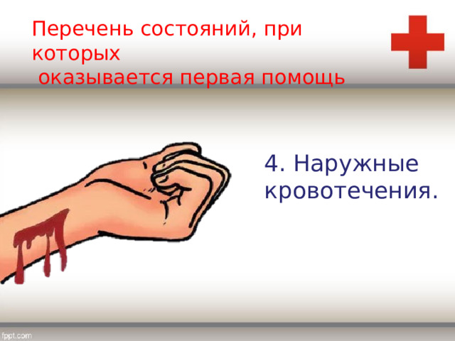 Перечень состояний, при которых  оказывается первая помощь 4. Наружные кровотечения. 