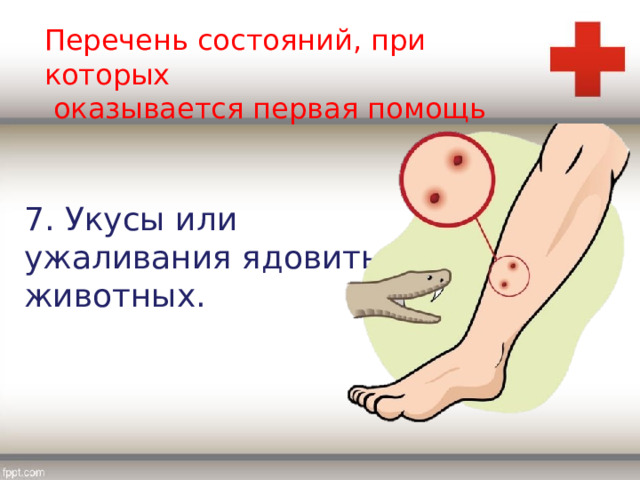 Перечень состояний, при которых  оказывается первая помощь 7. Укусы или ужаливания ядовитых животных. 