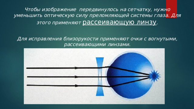 Чтобы изображение передвинулось на сетчатку, нужно уменьшить оптическую силу преломляющей системы глаза. Для этого применяют  рассеивающую линзу .  Для исправления близорукости применяют очки с вогнутыми, рассеивающими линзами. 