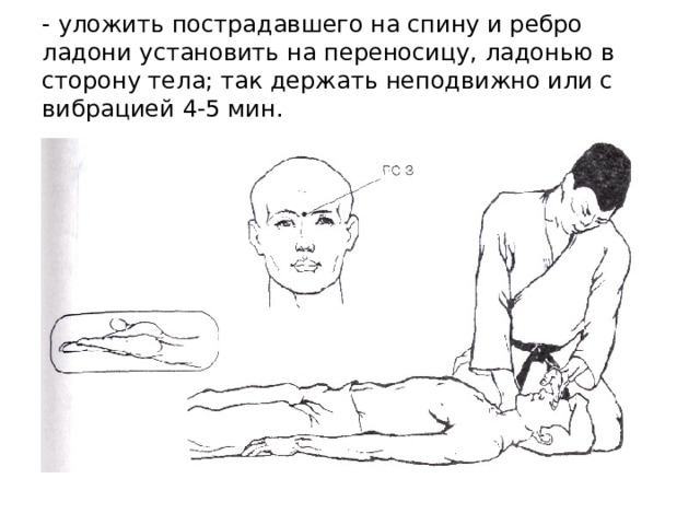 - уложить пострадавшего на спину и ребро ладони установить на переносицу, ладонью в сторону тела; так держать неподвижно или с вибрацией 4-5 мин. 