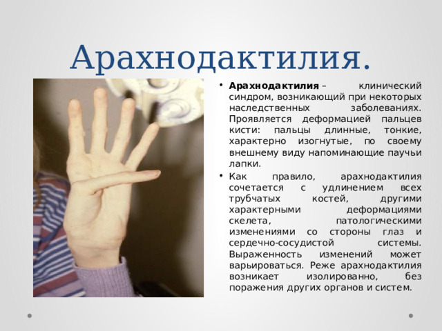 Арахнодактилия. Арахнодактилия  – клинический синдром, возникающий при некоторых наследственных заболеваниях. Проявляется деформацией пальцев кисти: пальцы длинные, тонкие, характерно изогнутые, по своему внешнему виду напоминающие паучьи лапки. Как правило, арахнодактилия сочетается с удлинением всех трубчатых костей, другими характерными деформациями скелета, патологическими изменениями со стороны глаз и сердечно-сосудистой системы. Выраженность изменений может варьироваться. Реже арахнодактилия возникает изолированно, без поражения других органов и систем.  