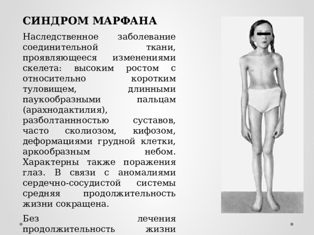 СИНДРОМ МАРФАНА Наследственное заболевание соединительной ткани, проявляющееся изменениями скелета: высоким ростом с относительно коротким туловищем, длинными паукообразными пальцам (арахнодактилия), разболтаннностью суставов, часто сколиозом, кифозом, деформациями грудной клетки, аркообразным небом. Характерны также поражения глаз. В связи с аномалиями сердечно-сосудистой системы средняя продолжительность жизни сокращена. Без лечения продолжительность жизни часто ограничивается 30-40 годами. 