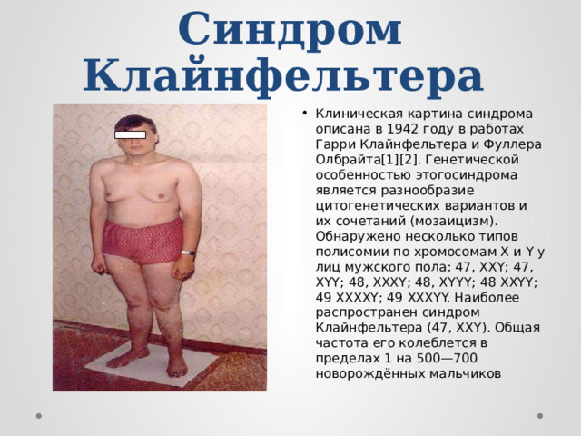Синдром Клайнфельтера   Клиническая картина синдрома описана в 1942 году в работах Гарри Клайнфельтера и Фуллера Олбрайта[1][2]. Генетической особенностью этогосиндрома является разнообразие цитогенетических вариантов и их сочетаний (мозаицизм). Обнаружено несколько типов полисомии по хромосомам X и Y у лиц мужского пола: 47, XXY; 47, XYY; 48, XXXY; 48, XYYY; 48 XXYY; 49 XXXXY; 49 XXXYY. Наиболее распространен синдром Клайнфельтера (47, XXY). Общая частота его колеблется в пределах 1 на 500—700 новорождённых мальчиков 