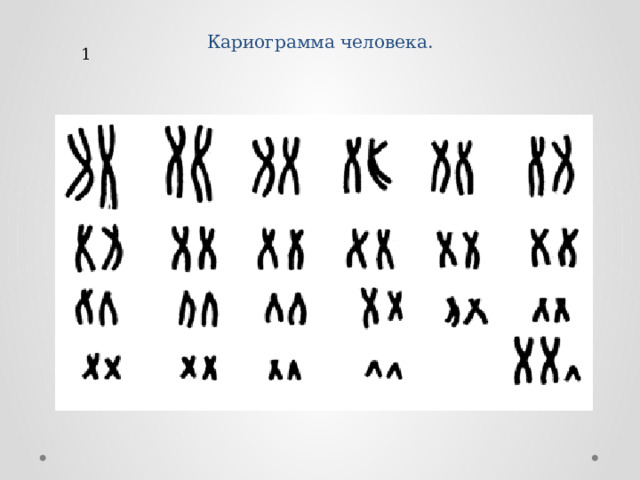 Кариограмма человека. 1 