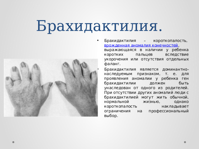 Брахидактилия. Брахидактилия – короткопалость,  врожденная аномалия конечностей , выражающаяся в наличии у ребенка коротких пальцев вследствие укорочения или отсутствия отдельных фаланг. Брахидактилия является доминантно-наследуемым признаком, т. е. для проявления аномалии у ребенка ген брахидактилии должен быть унаследован от одного из родителей. При отсутствии других аномалий люди с брахидактилией могут жить обычной, нормальной жизнью, однако короткопалость накладывает ограничения на профессиональный выбор. 