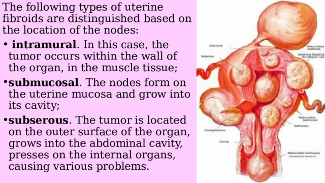The following types of uterine fibroids are distinguished based on the location of the nodes:  intramural . In this case, the tumor occurs within the wall of the organ, in the muscle tissue; submucosal . The nodes form on the uterine mucosa and grow into its cavity; subserous . The tumor is located on the outer surface of the organ, grows into the abdominal cavity, presses on the internal organs, causing various problems. 