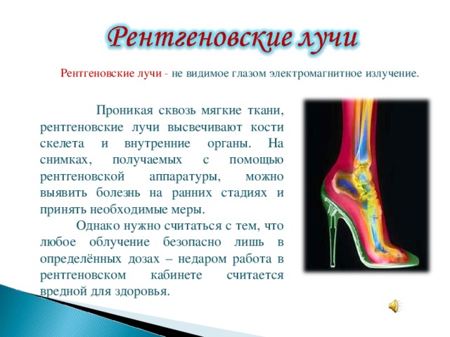  Рентгеновские лучи  - не видимое глазом электромагнитное излучение.  Проникая сквозь мягкие ткани, рентгеновские лучи высвечивают кости скелета и внутренние органы. На снимках, получаемых с помощью рентгеновской аппаратуры, можно выявить болезнь на ранних стадиях и принять необходимые меры.  Однако нужно считаться с тем, что любое облучение безопасно лишь в определённых дозах – недаром работа в рентгеновском кабинете считается вредной для здоровья. 