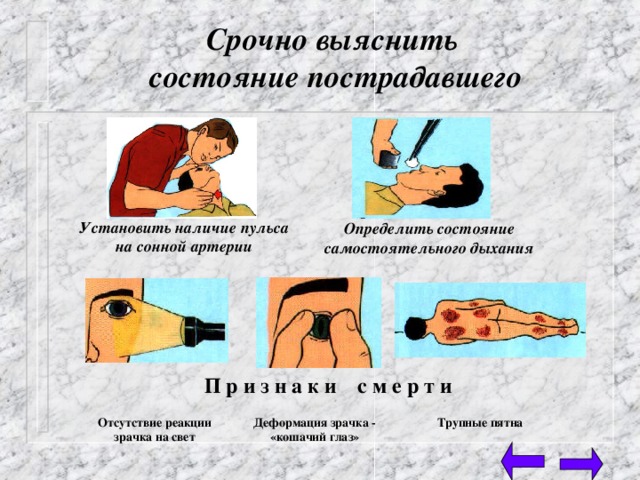 Срочно выяснить  состояние пострадавшего Установить наличие пульса на сонной артерии Определить состояние самостоятельного дыхания П р и з н а к и с м е р т и Отсутствие реакции зрачка на свет Деформация зрачка - «кошачий глаз» Трупные пятна 