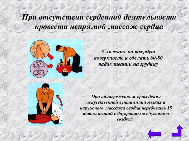 При отсутствии сердечной деятельности провести непрямой массаж сердца Уложить на твердую поверхность и сделать 60-80 надавливаний на грудину При одновременном проведении искусственной вентиляции легких и наружного массажа сердца чередовать 15 надавливаний с двукратным вдуванием воздуха 