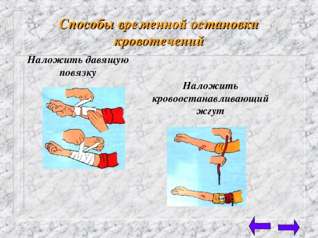 Способы временной остановки кровотечений Наложить давящую повязку Наложить кровоостанавливающий жгут 