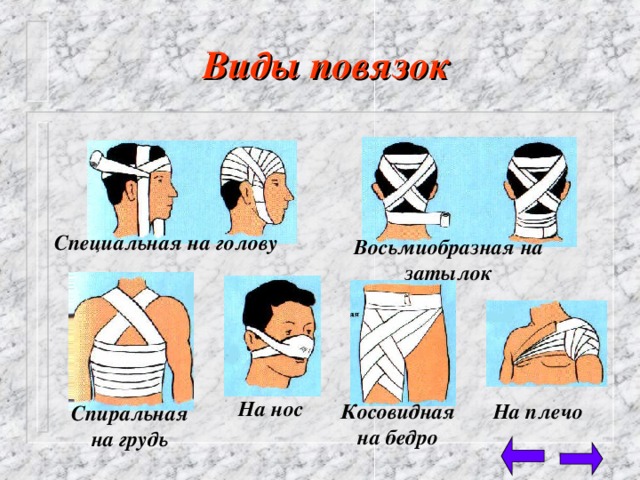 Виды повязок  Специальная на голову Восьмиобразная на затылок На нос Косовидная на бедро На плечо Спиральная на грудь 