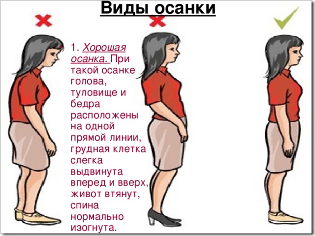 Виды осанки   1.  Хорошая осанка.   При такой осанке голова, туловище и бедра расположены на одной прямой линии, грудная клетка слегка выдвинута вперед и вверх, живот втянут, спина нормально изогнута. 