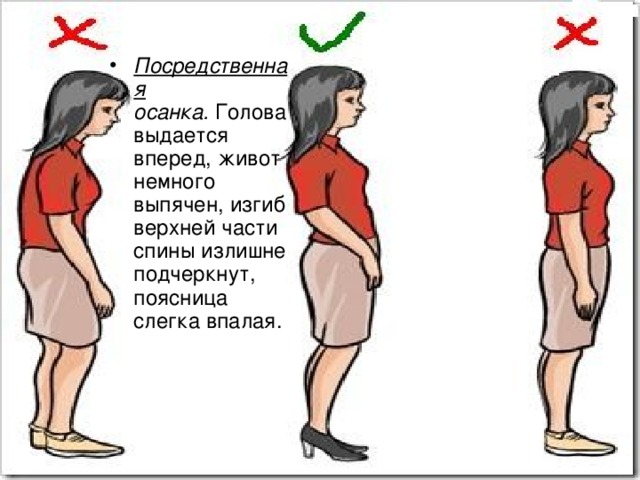 Посредственная осанка.  Голова выдается вперед, живот немного выпячен, изгиб верхней части спины излишне подчеркнут, поясница слегка впалая. 