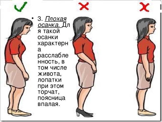 3.  Плохая осанка.   Для такой осанки характерна расслабленность, в том числе живота, лопатки при этом торчат, поясница впалая. 