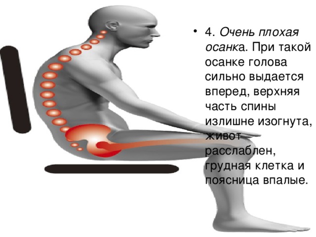 4.  Очень плохая осанк а. При такой осанке голова сильно выдается вперед, верхняя часть спины излишне изогнута, живот расслаблен, грудная клетка и поясница впалые. 