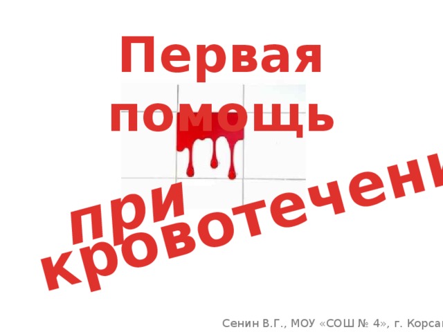 при кровотечении Первая помощь Сенин В.Г., МОУ «СОШ № 4», г. Корсаков 