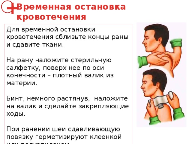 Временная остановка кровотечения + Для временной остановки кровотечения сблизьте концы раны и сдавите ткани.   На рану наложите стерильную салфетку, поверх нее по оси конечности – плотный валик из материи. Бинт, немного растянув, наложите на валик и сделайте закрепляющие ходы. При ранении шеи сдавливающую повязку герметизируют клеенкой или полиэтиленом. 