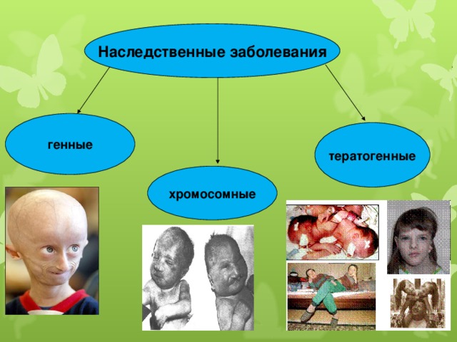 Наследственные заболевания генные тератогенные хромосомные 