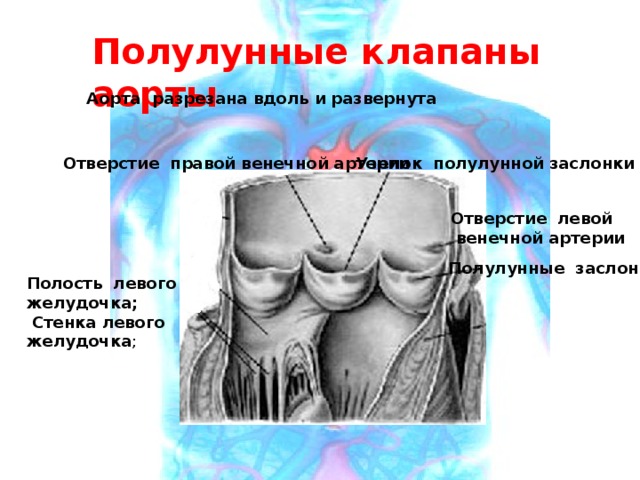 Полулунные клапаны аорты Аорта разрезана вдоль и развернута Отверстие правой венечной артерии Узелок полулунной заслонки Отверстие левой  венечной артерии Полулунные заслонки Полость левого желудочка;  Стенка левого желудочка ; 