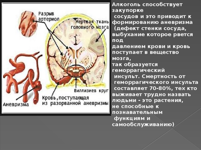 Алкоголь способствует закупорке  сосудов и это приводит к формированию аневризма  (дефект стенки сосуда, выбухание которое рвется под давлением крови и кровь поступает в вещество мозга, так образуется геморрагический  инсульт. Смертность от  геморрагического инсульта  составляет 70-80%, тех кто выживает трудно назвать людьми - это растения, не способные к познавательным  функциям и самообслуживанию) 