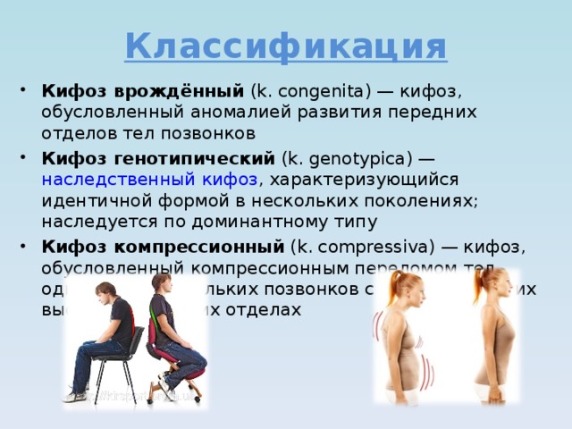 Классификация Кифоз врождённый (k. congenita) — кифоз, обусловленный аномалией развития передних отделов тел позвонков Кифоз генотипический (k. genotypica) — наследственный кифоз , характеризующийся идентичной формой в нескольких поколениях; наследуется по доминантному типу Кифоз компрессионный (k. compressiva) — кифоз, обусловленный компрессионным переломом тел одного или нескольких позвонков с уменьшением их высоты в передних отделах 
