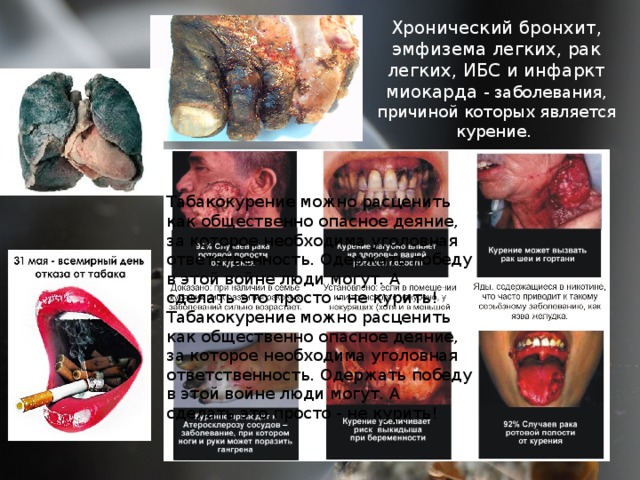 Хронический бронхит, эмфизема легких, рак легких, ИБС и инфаркт миокарда - заболевания, причиной которых является курение. Табакокурение можно расценить как общественно опасное деяние, за которое необходима уголовная ответственность. Одержать победу в этой войне люди могут. А сделать это просто - не курить! Табакокурение можно расценить как общественно опасное деяние, за которое необходима уголовная ответственность. Одержать победу в этой войне люди могут. А сделать это просто - не курить! 