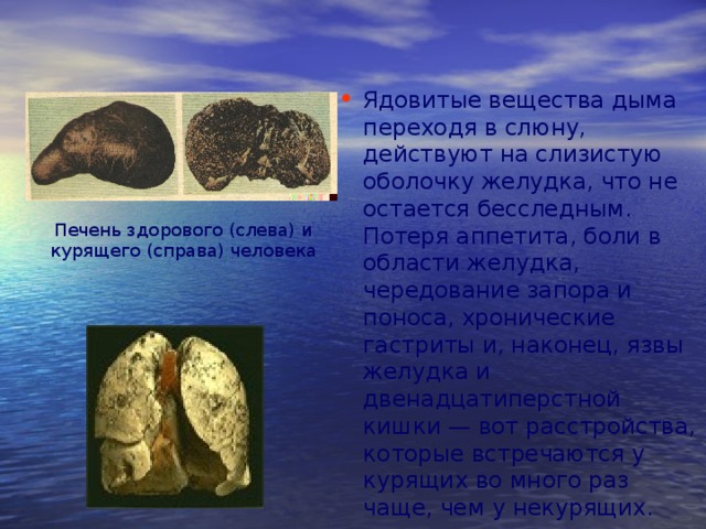 Ядовитые вещества дыма переходя в слюну, действуют на слизистую оболочку желудка, что не остается бесследным. Потеря аппетита, боли в области желудка, чередование запора и поноса, хронические гастриты и, наконец, язвы желудка и двенадцатиперстной кишки — вот расстройства, которые встречаются у курящих во много раз чаще, чем у некурящих. Печень здорового (слева) и курящего (справа) человека 