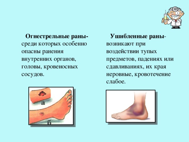  Ушибленные раны -возникают при воздействии тупых предметов, падениях или сдавливаниях, их края неровные, кровотечение слабое.  Огнестрельные раны- среди которых особенно опасны ранения внутренних органов, головы, кровеносных сосудов. 