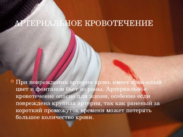 Артериальное кровотечение При повреждении артерии кровь имеет ярко-алый цвет и фонтаном бьет из раны. Артериальное кровотечение опасно для жизни, особенно если повреждена крупная артерия, так как раненый за короткий промежуток времени может потерять большое количество крови. 