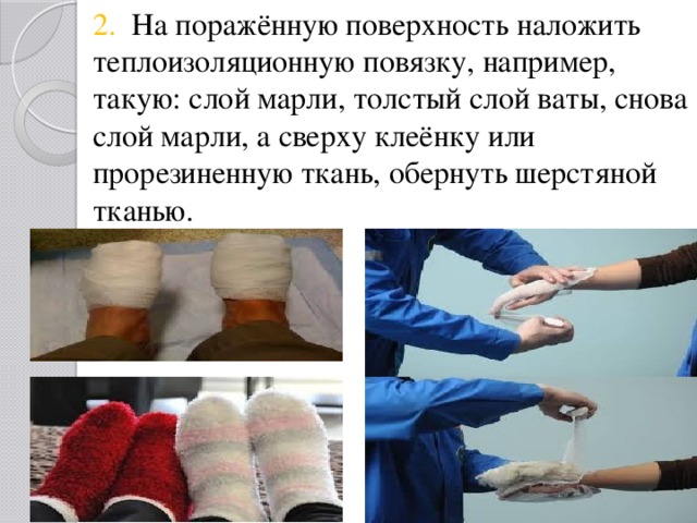 2. На поражённую поверхность наложить теплоизоляционную повязку, например, такую: слой марли, толстый слой ваты, снова слой марли, а сверху клеёнку или прорезиненную ткань, обернуть шерстяной тканью. 