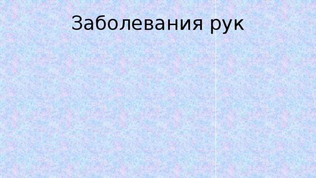 Заболевания рук 