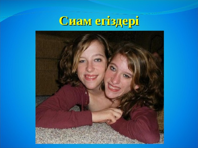 Сиам егіздері 