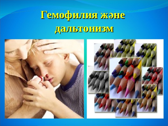 Гемофилия ж әне   дальтонизм 