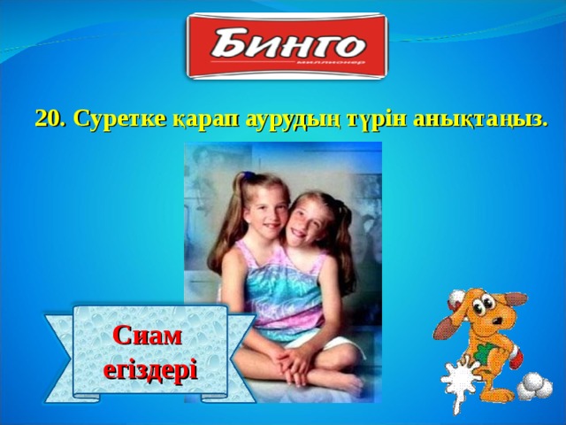20 . Суретке қарап аурудың түрін анықтаңыз. Сиам егіздері 